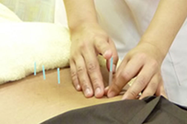 いまだ鍼灸整骨院