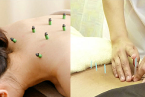 いまだ鍼灸整骨院