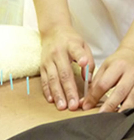 いまだ鍼灸整骨院