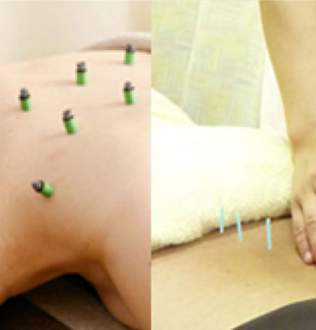 いまだ鍼灸整骨院